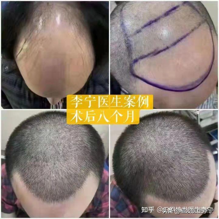 小巷中的秘密美发宝藏，最新种头发的秘密技巧